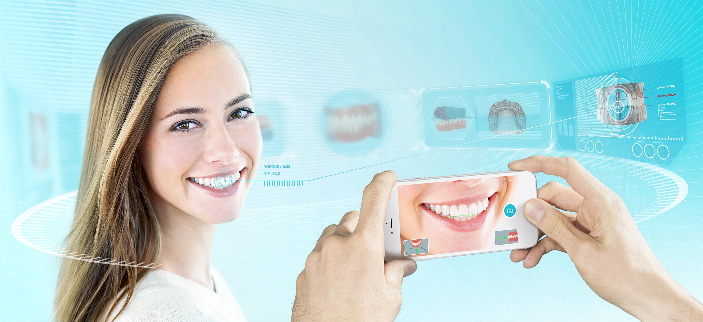 Dental Monitoring Image