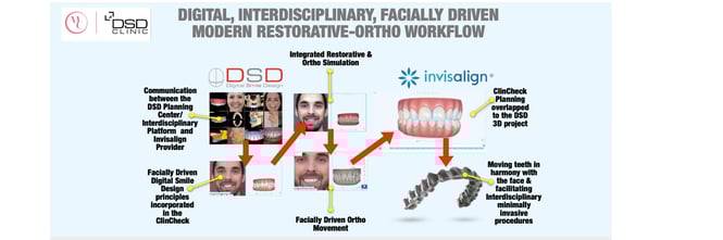 Invisalign