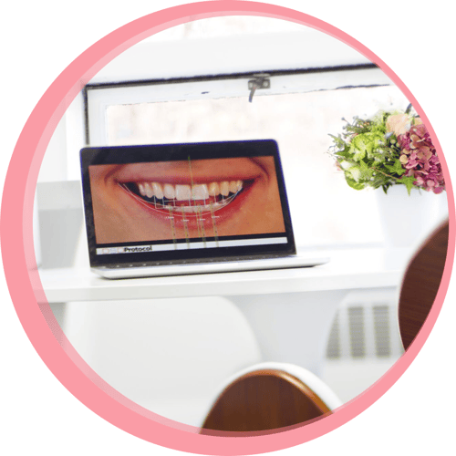 A laptop in a room at Maria Cardenas DMD dental clinic shows the digital design of a patient's new smile on screen.
