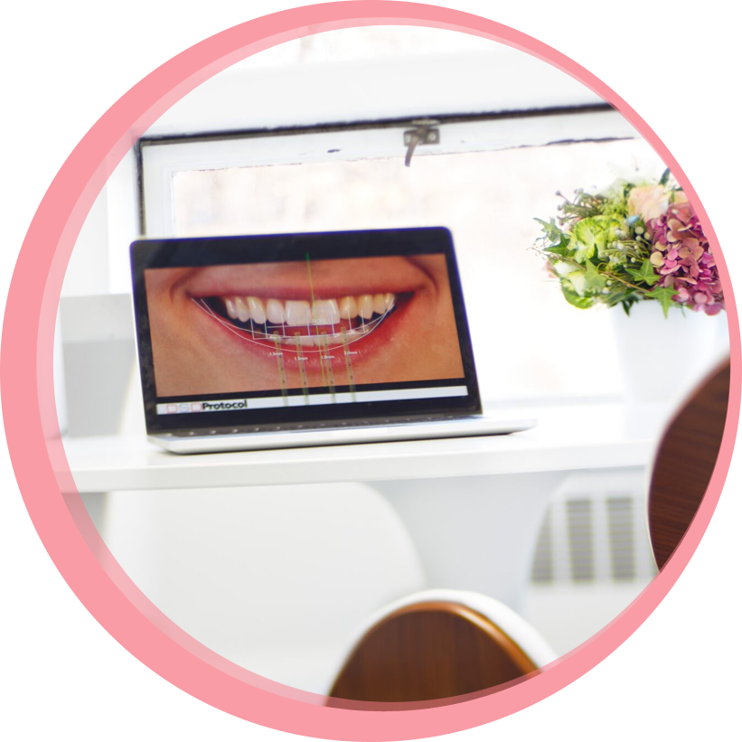 A laptop in a room at Maria Cardenas DMD dental clinic showing the digital design of a patient's new smile on screen.
