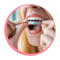 The most common Invisalign mistakes and how to avoid them