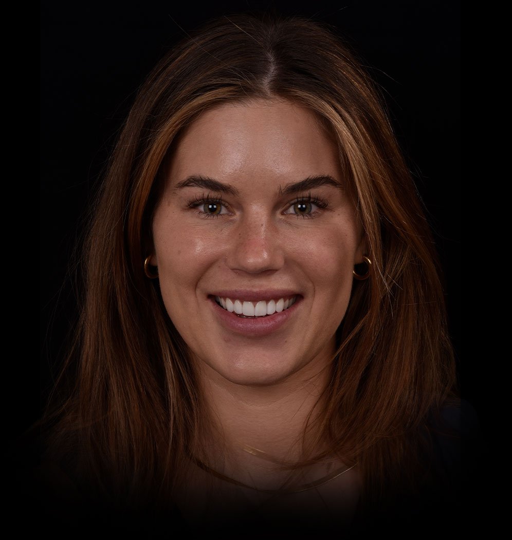 Happy Patient after Smile Makeover