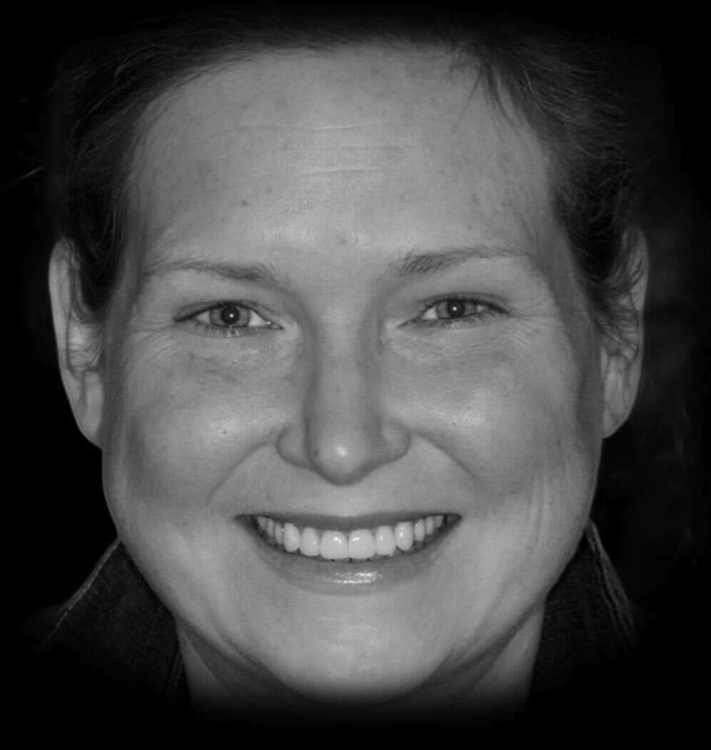 Caroline Smile Transformation