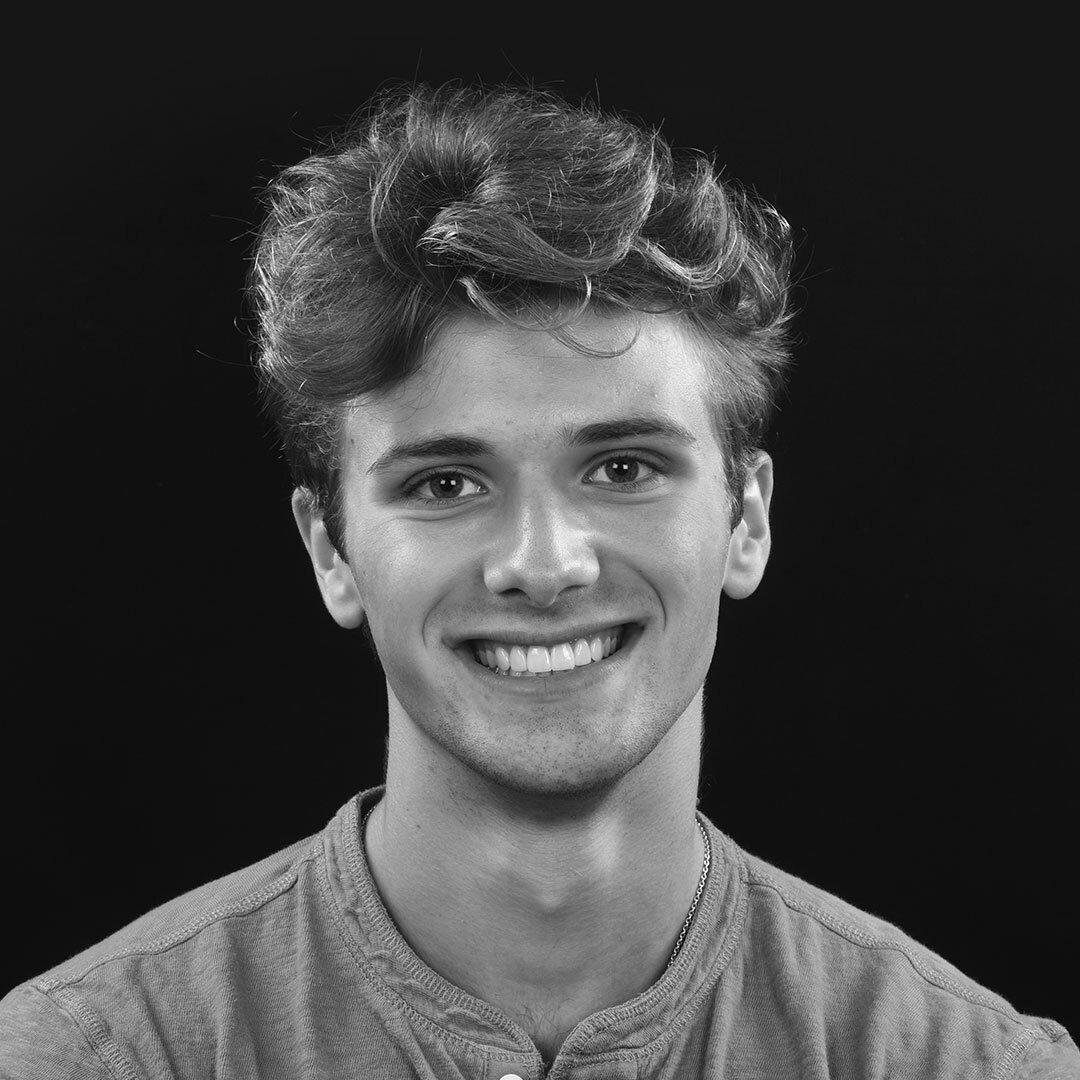 Devan Smile Transformation Highlights