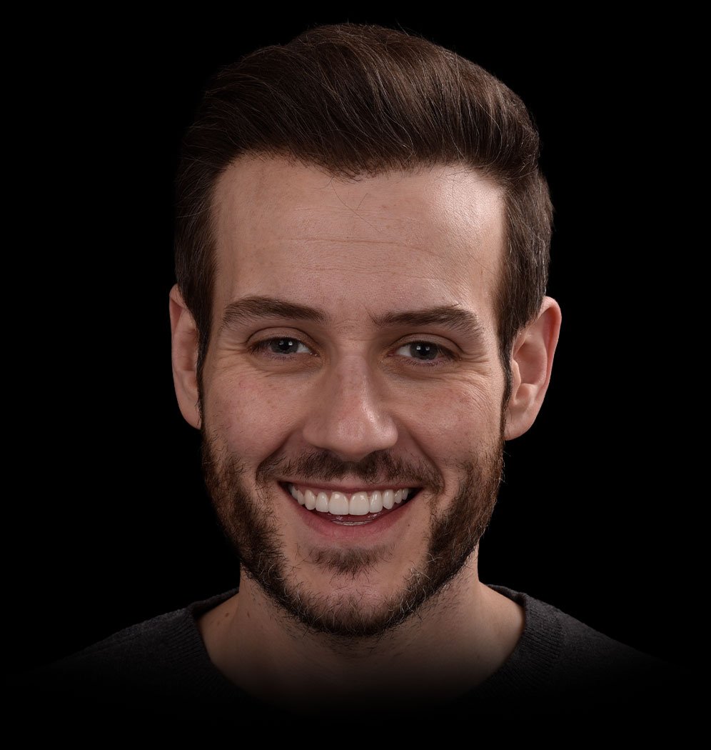 Greg Smile Transformation