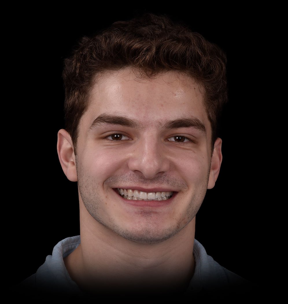 Jeffrey Smile Transformation