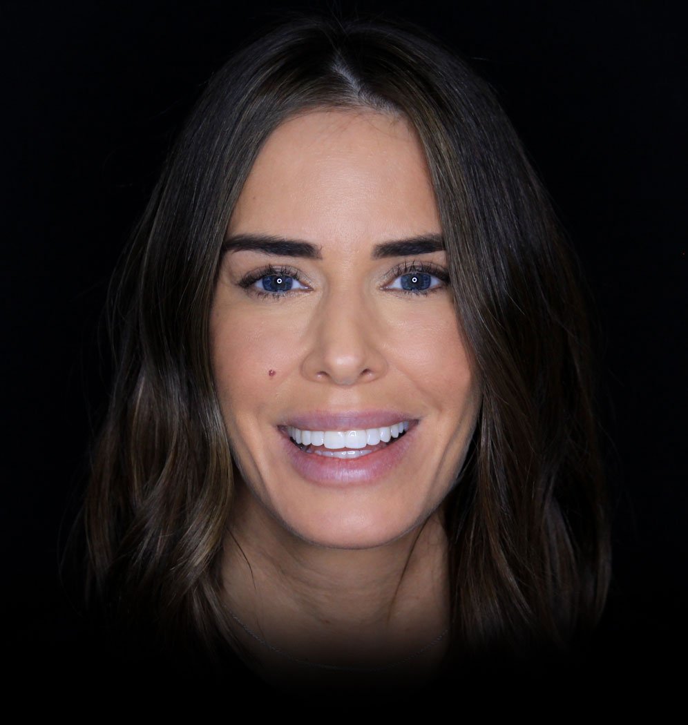 Jenna Smile Transformation