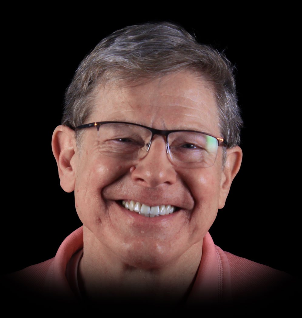 Jim Smile Transformation