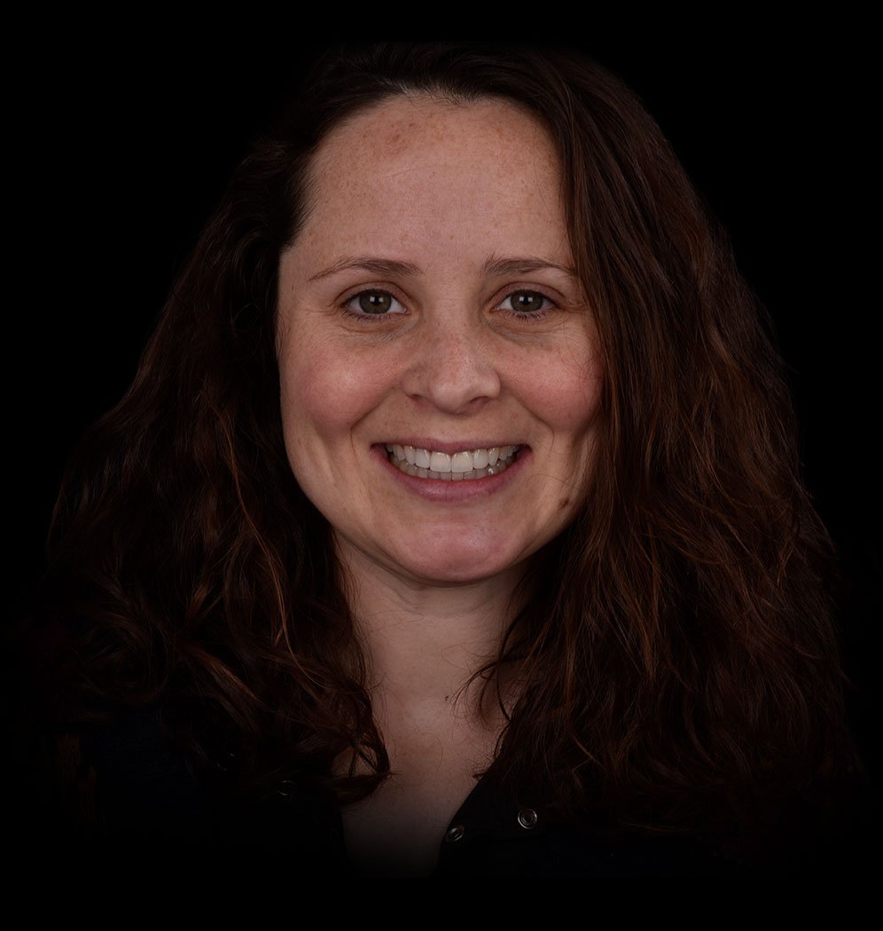 Katie Smile Transformation