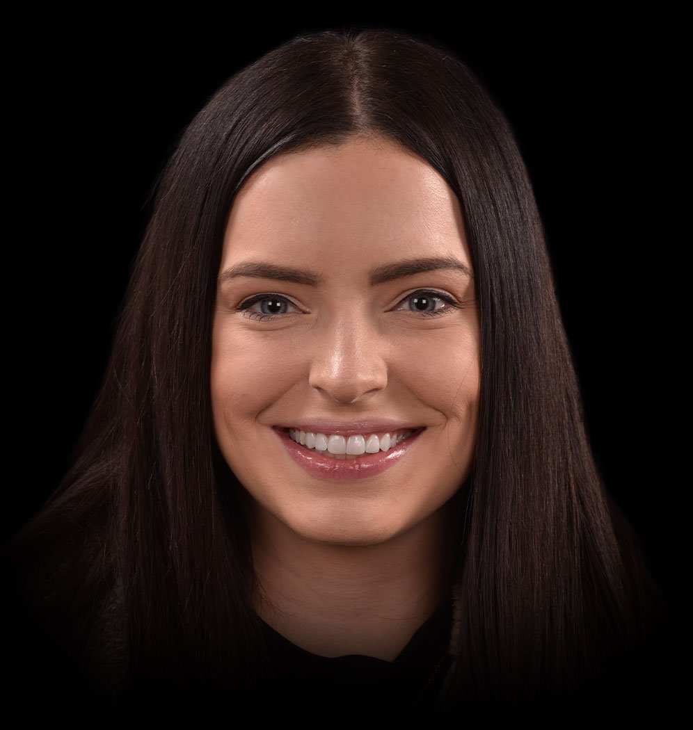 Kylie Smile Transformation