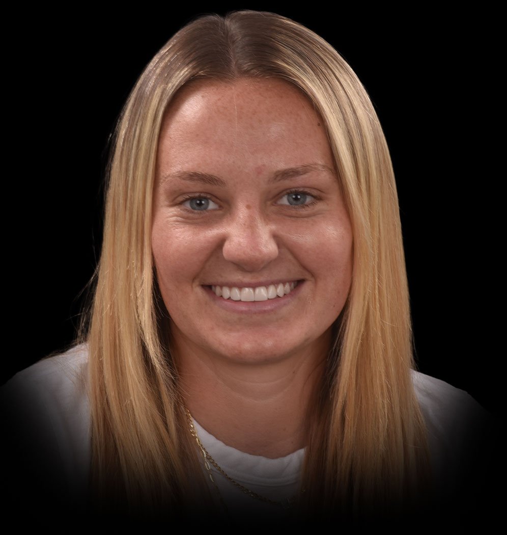 Lexi Smile Transformation