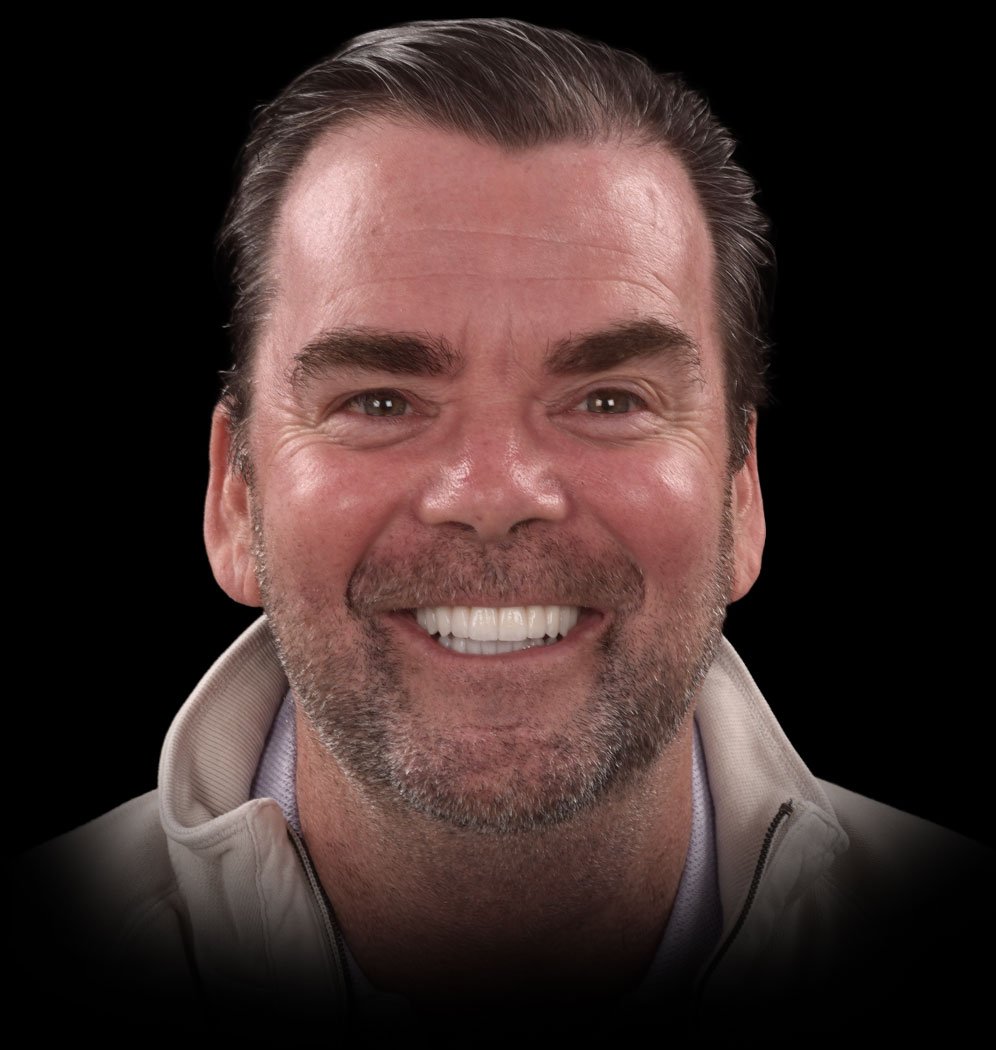 Mark Smile Transformation