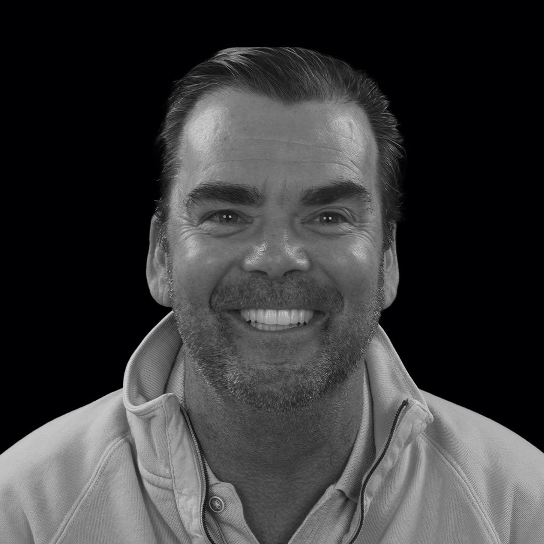 Mark Smile Transformation Highlights