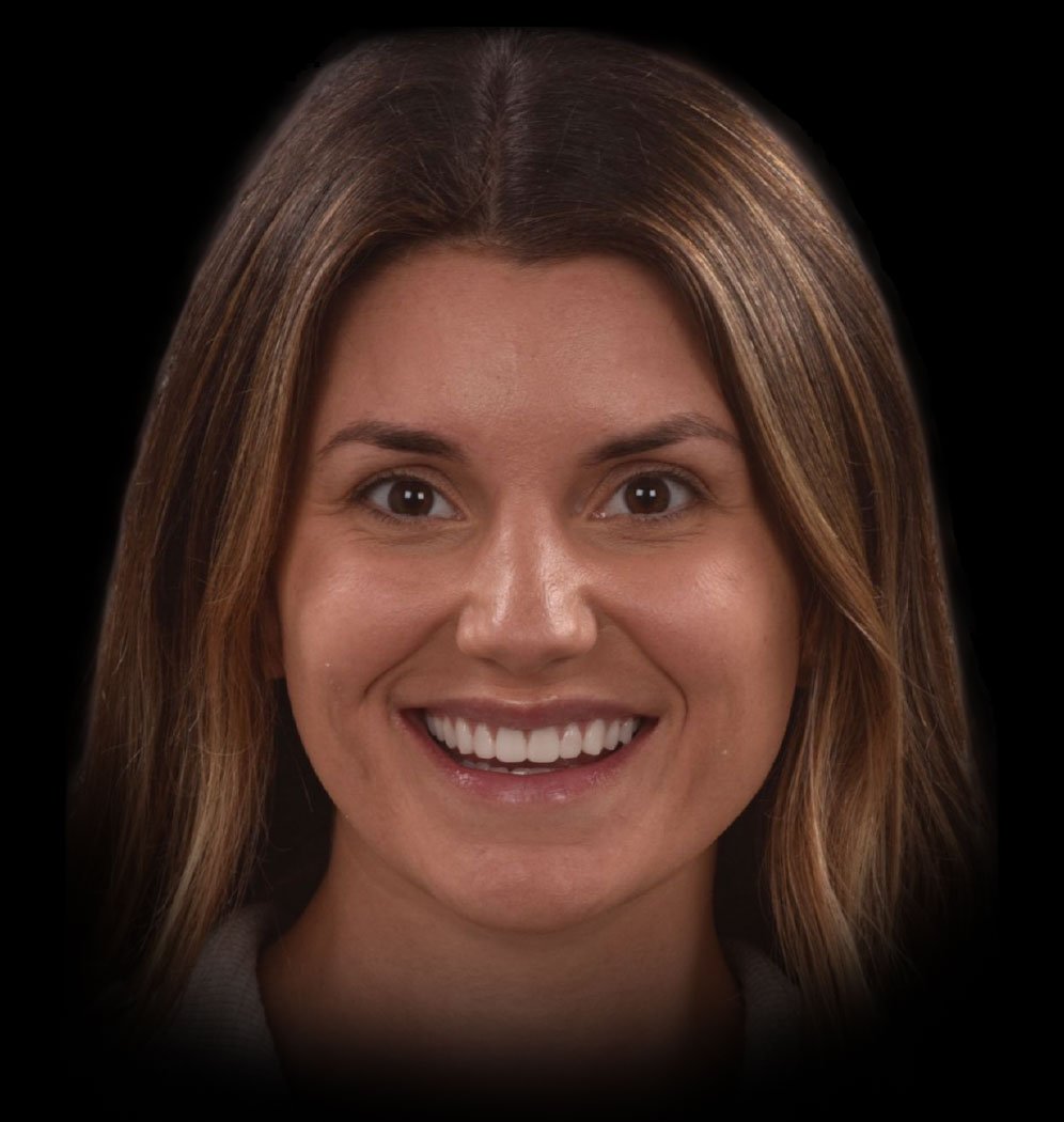 Marlana Smile Transformation