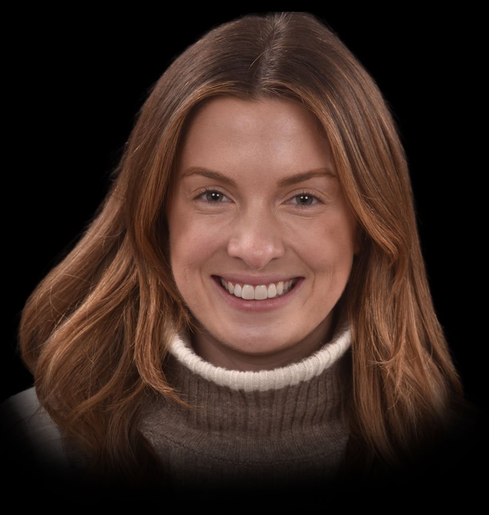 Meghan Smile Transformation