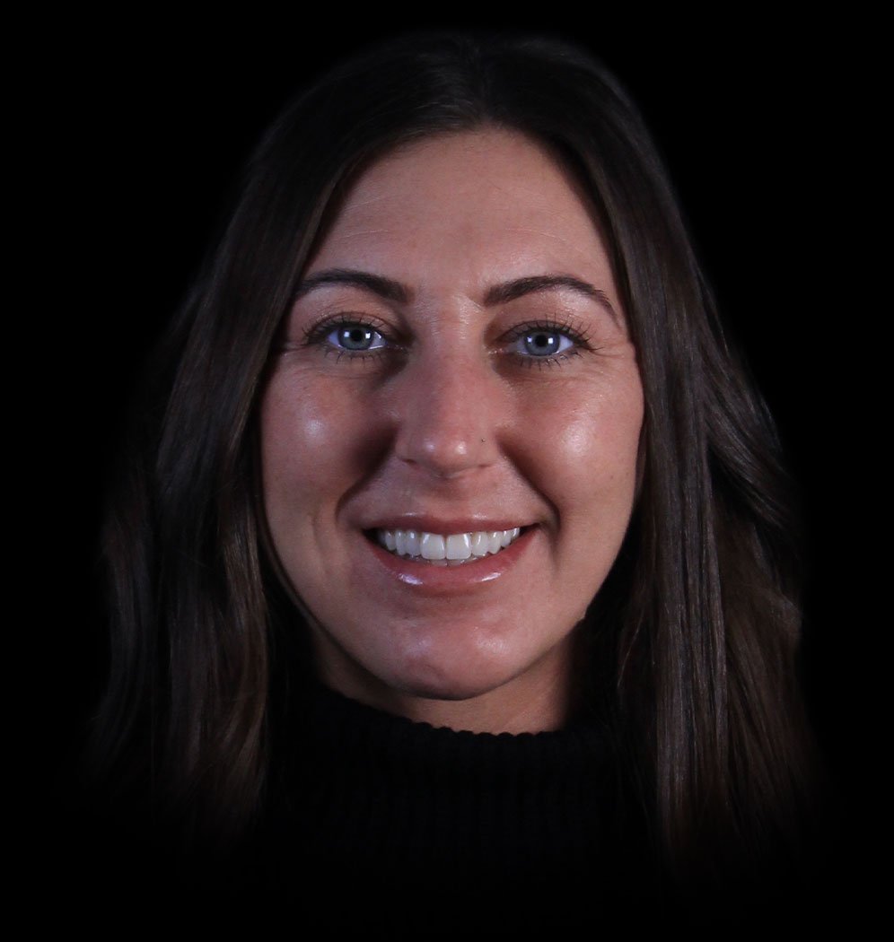 Nichol Smile Transformation