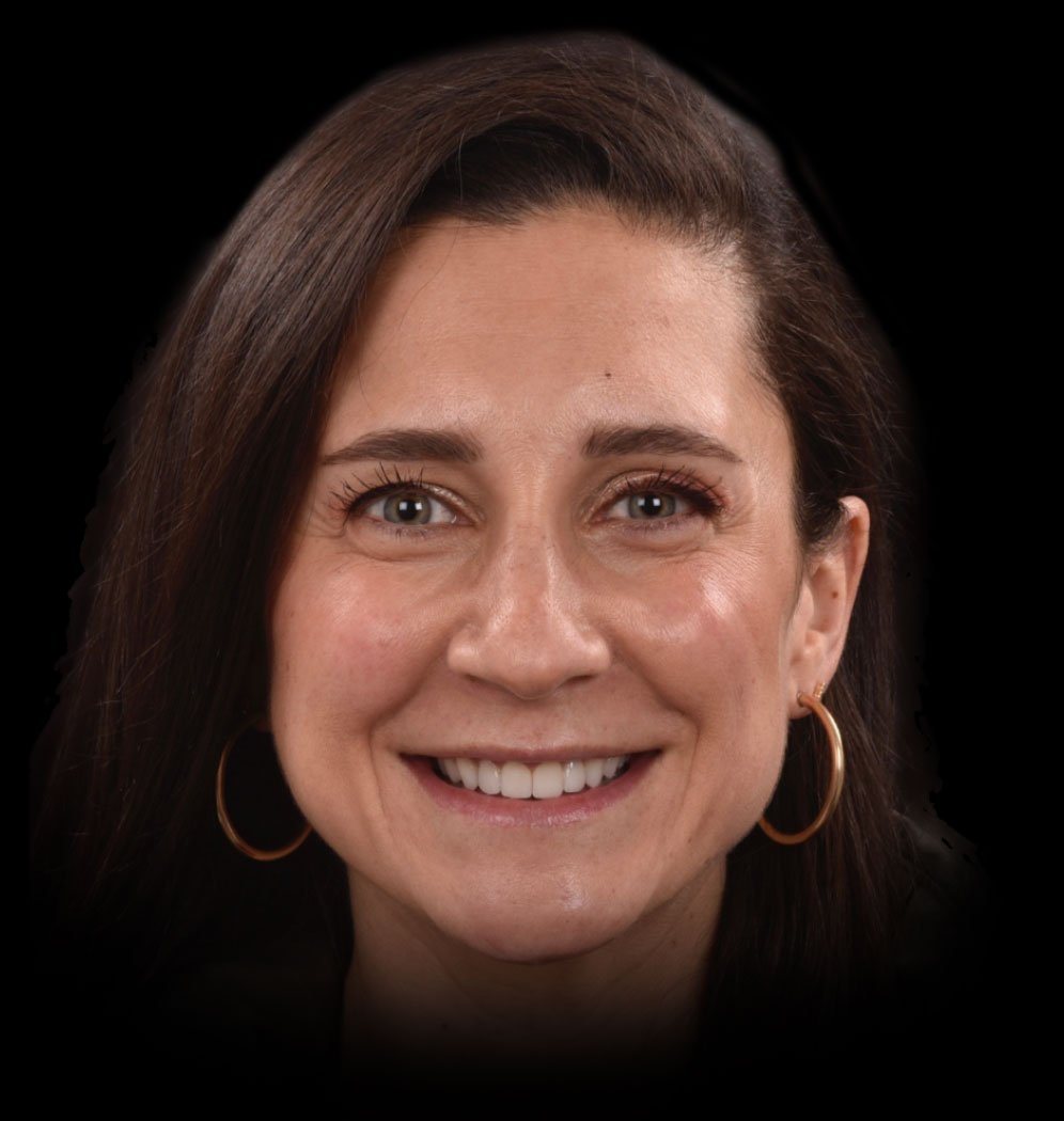 Rebecca Smile Transformation