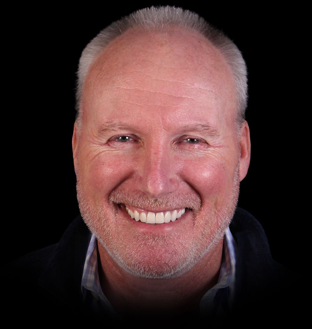 Terry Smile Transformation