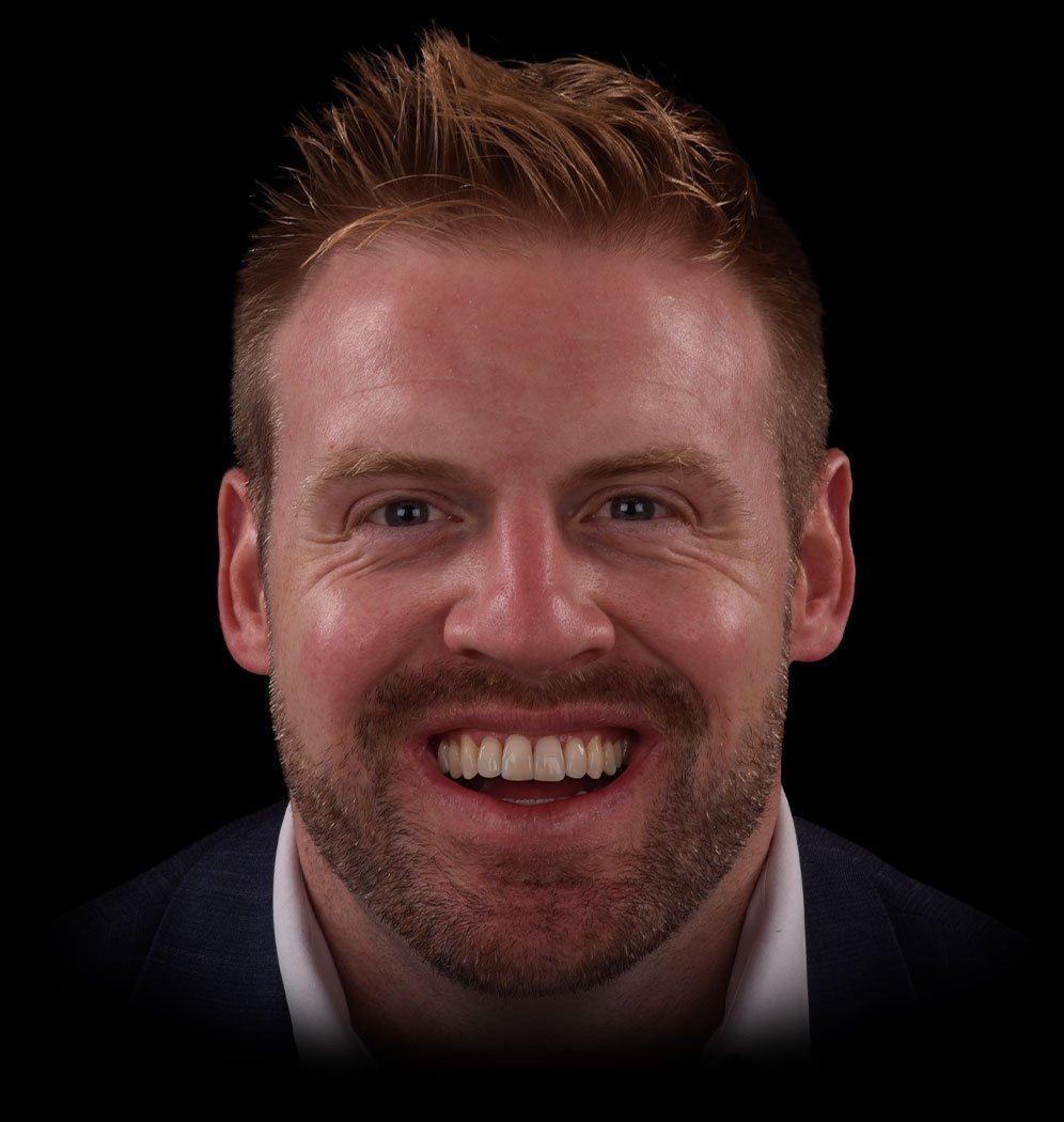 Thomas Smile Transformation