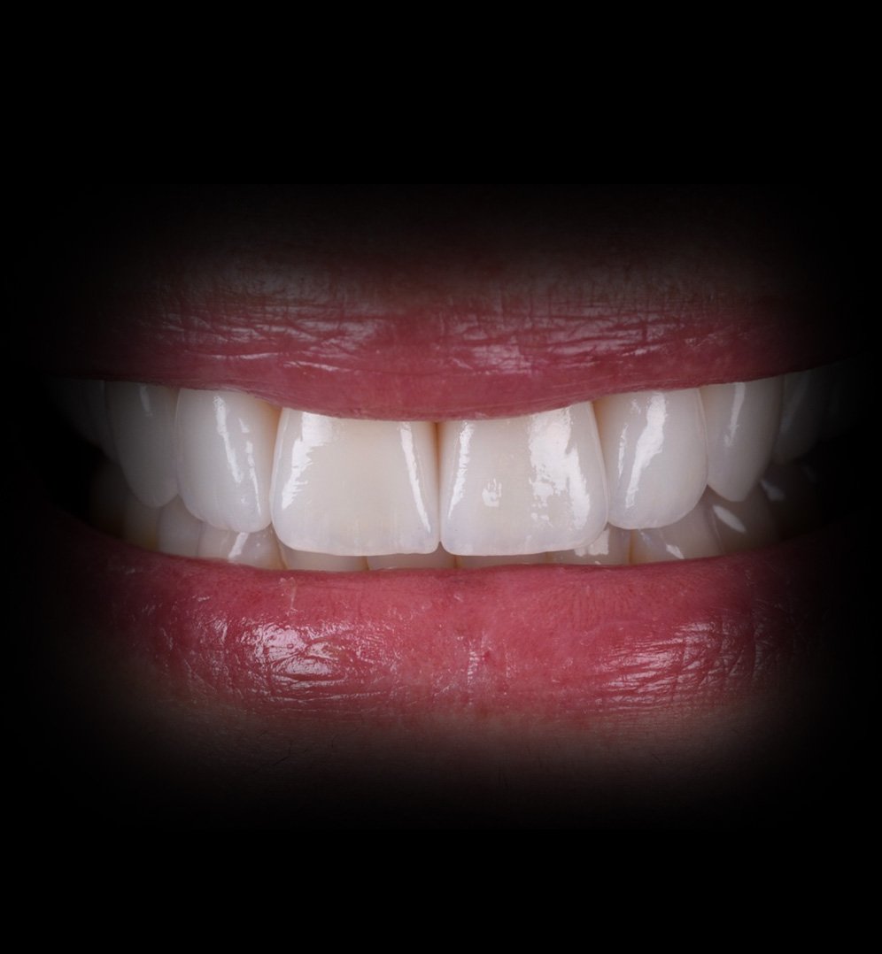 Danielle Smile Transformation Story