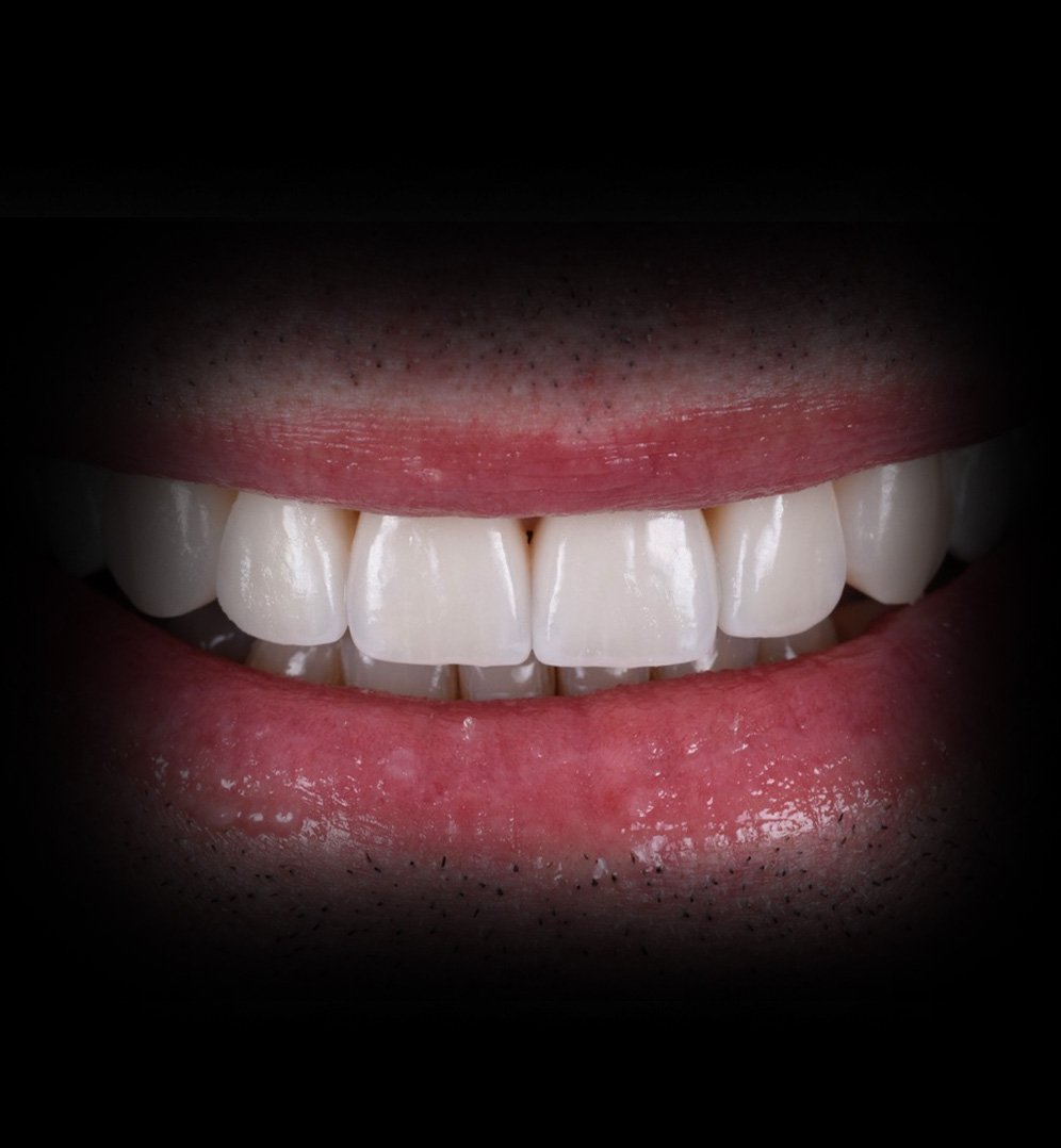 David Smile Transformation Story