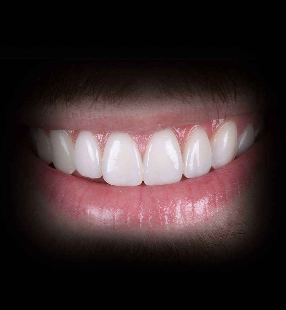 Dylan Smile Transformation Story