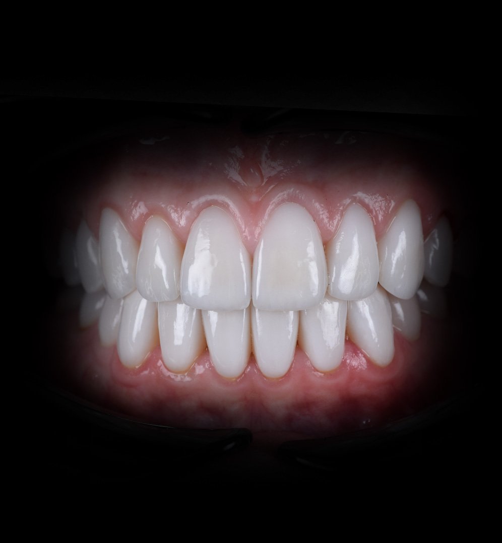 Jessica Smile Transformation Story