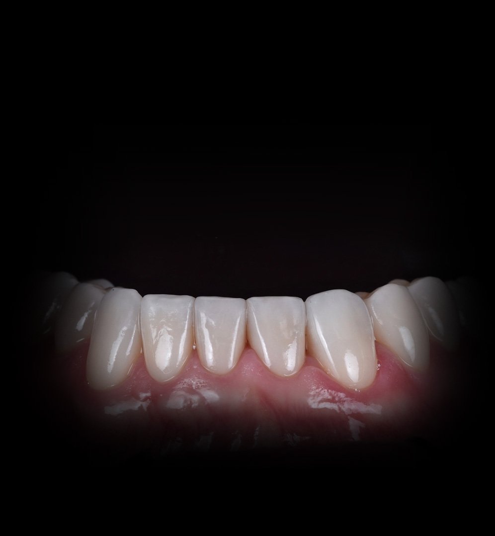 John Smile Transformation Story