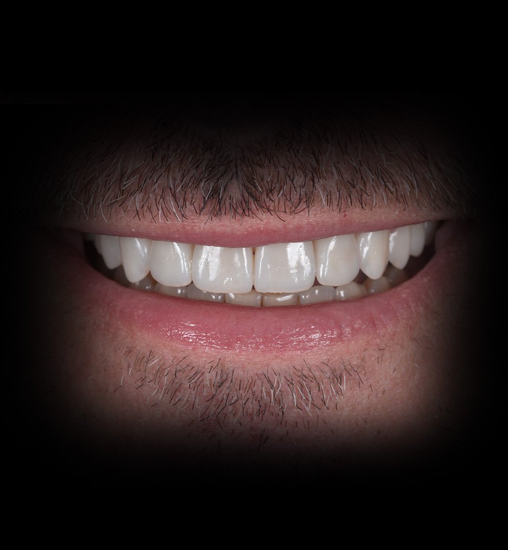 Justin Smile Transformation Story