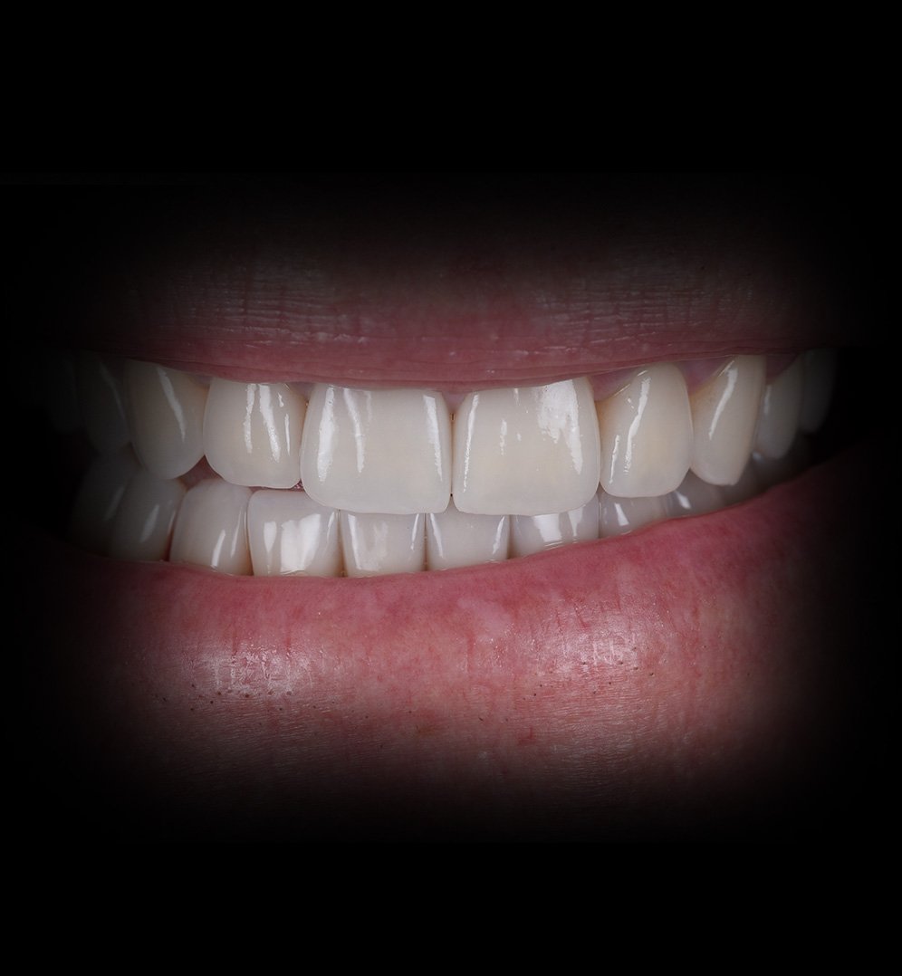 Larry Smile Transformation Story