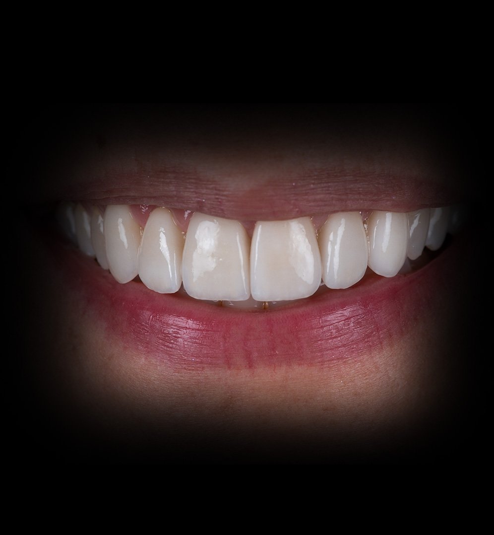 Madeline Smile Transformation Story