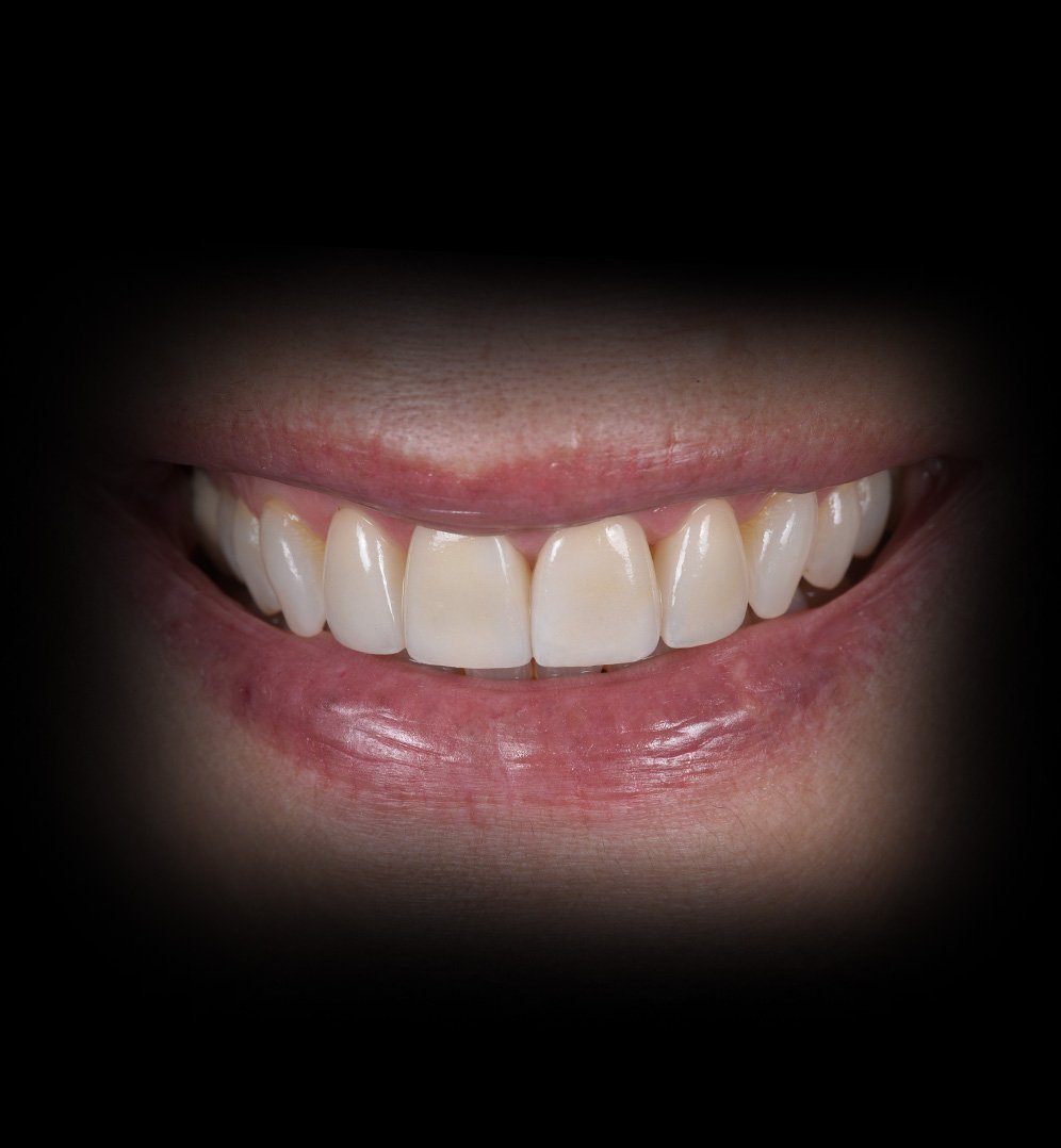 Susan Smile Transformation Story