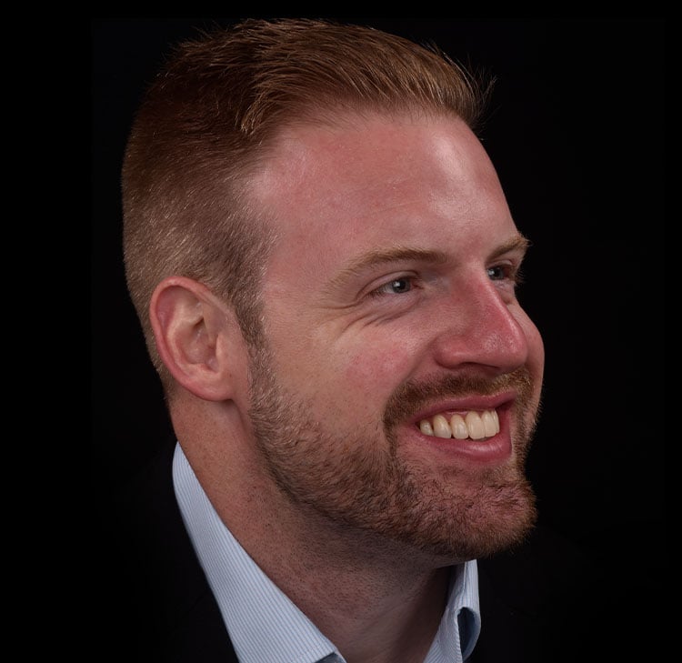 Happy Patient with Composite fillings