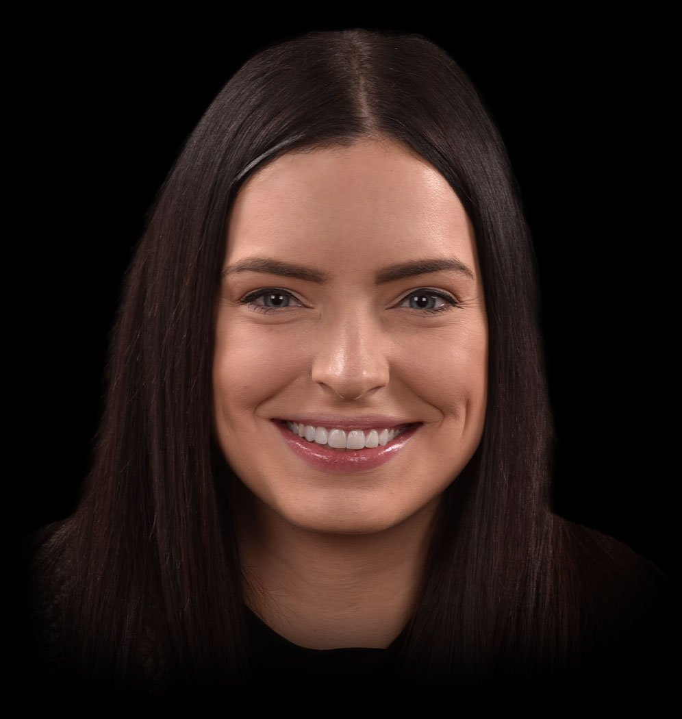 Kylie happy Invisalign® Patient