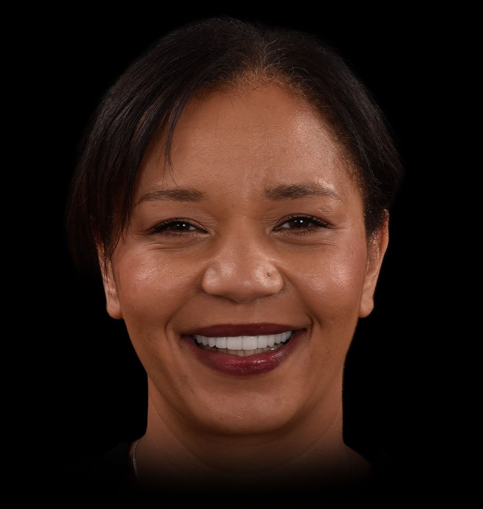 Happy Patient Tracy with Multiple Teeth Dental Implants