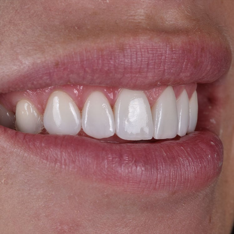 Close-up naturally looking smile