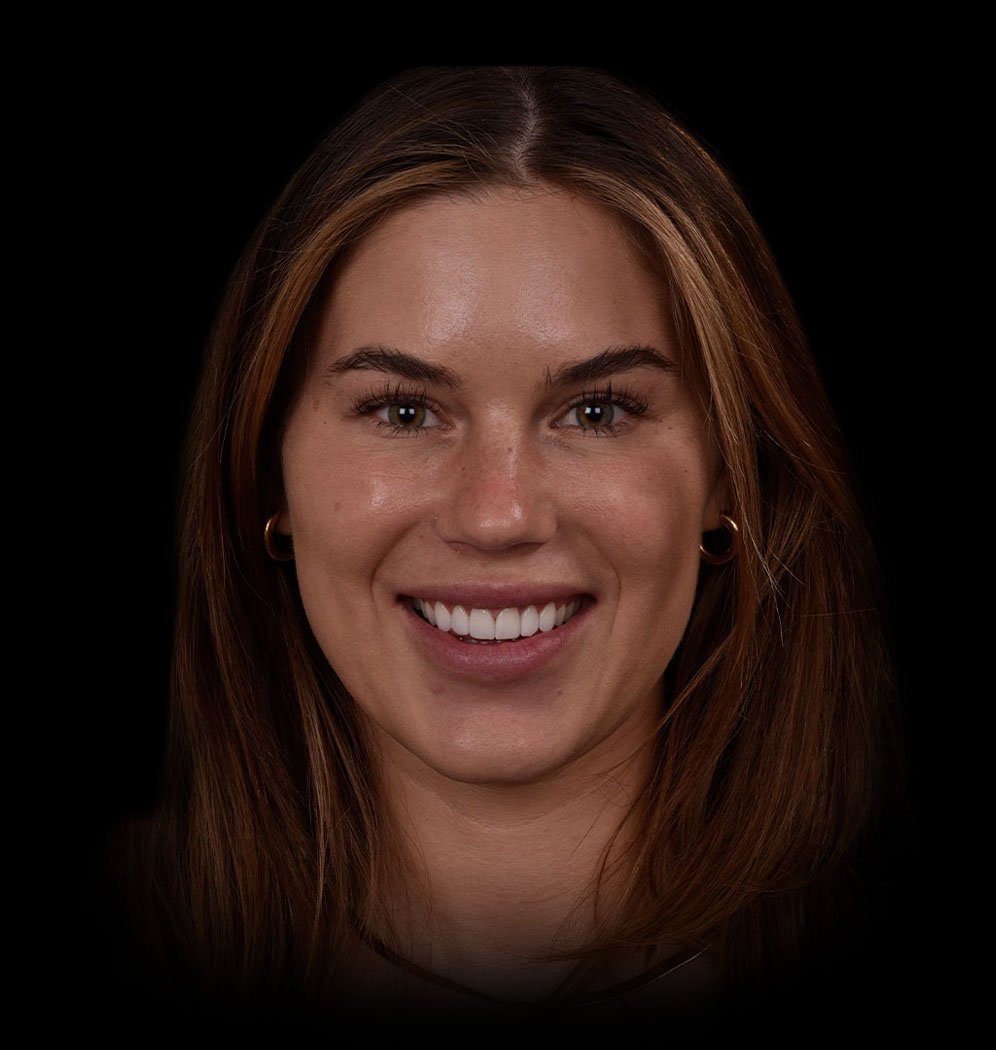 Woman smiling with natural looking teeth