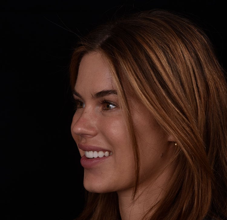 The Digital Smile Design Process