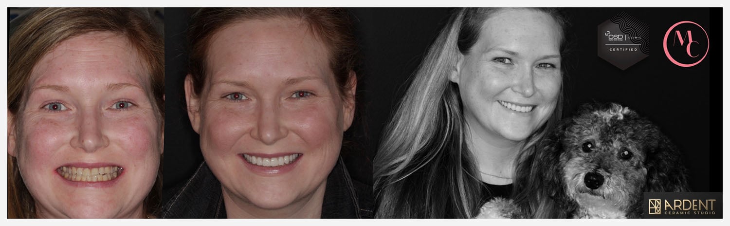 _Your handcrafted smile awaits!_INHOUSELAB