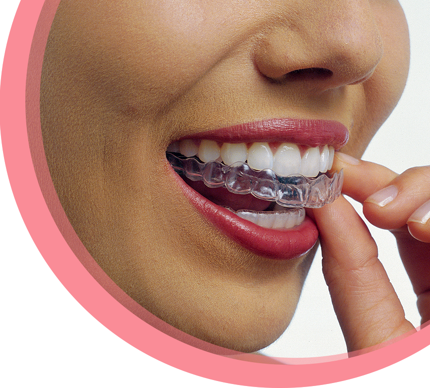 Cardenas-Invisalign-1