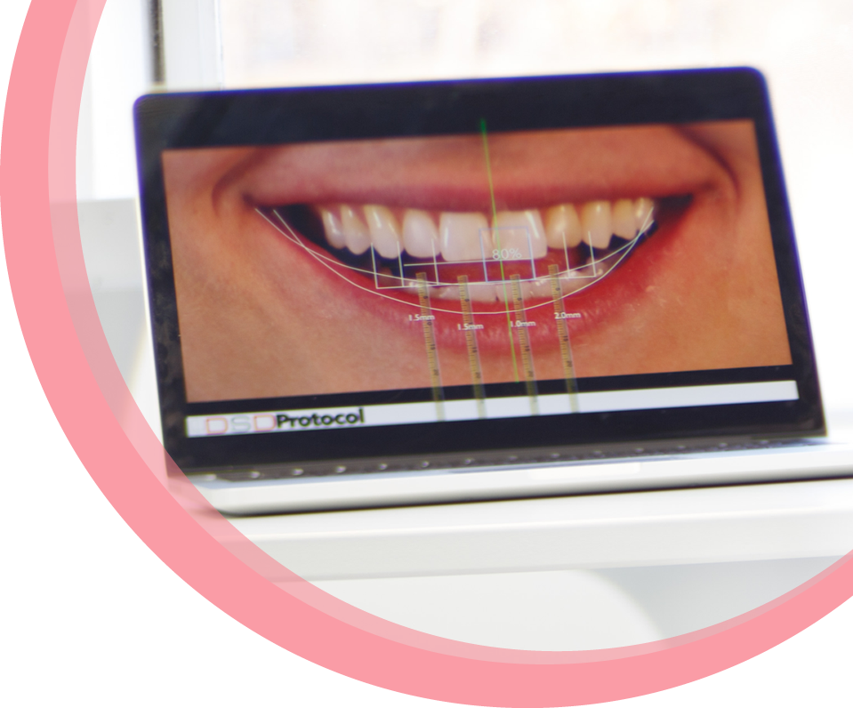 A laptop in a room at Maria Cardenas DMD dental clinic showing the digital design of a patient's new smile on screen.