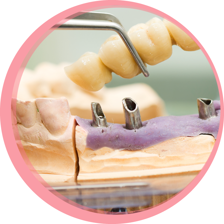 prosthodontics